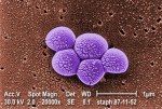 cdc_rf_photo_of_mrsa